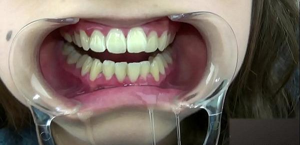 Teeth fetish